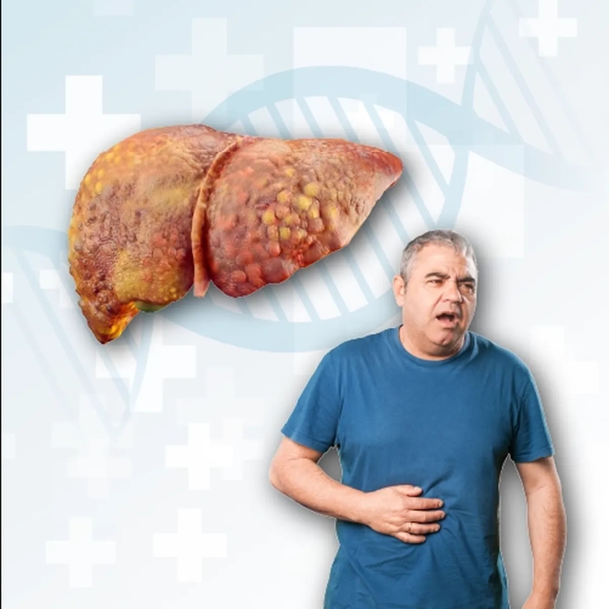 کبد چرب غیر الکلی (NAFLD) چیست؟ از تشخیص تا درمان قطعی (راهنمای کامل)