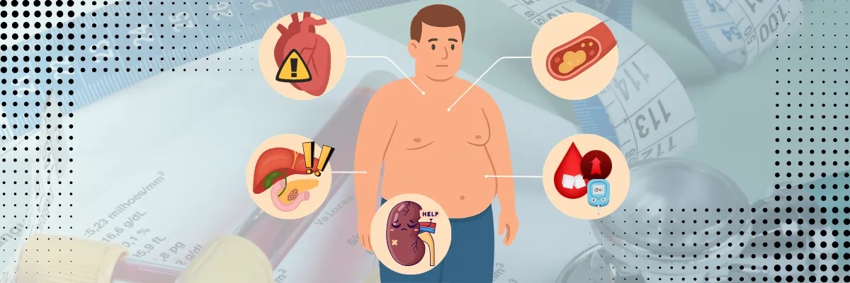 همه چیز در مورد سندرم متابولیک: دروازه ورود به دیابت نوع 2 و بیماری‌های قلبی