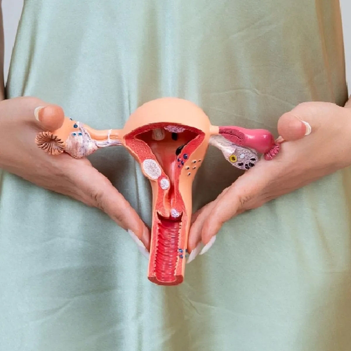 افتادگی رحم؛ علائم و نشانه هایی که باید جدی بگیرید