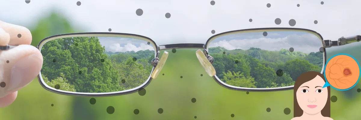 رتینوپاتی دیابتی چیست؟ علائم و راه‌های درمان