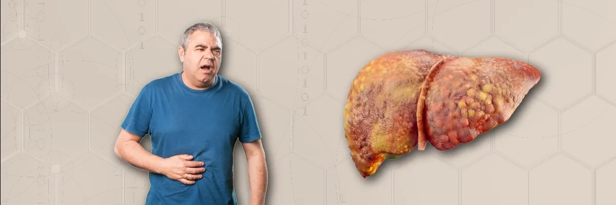 کبد چرب غیر الکلی (NAFLD) چیست؟ از تشخیص تا درمان قطعی (راهنمای کامل)