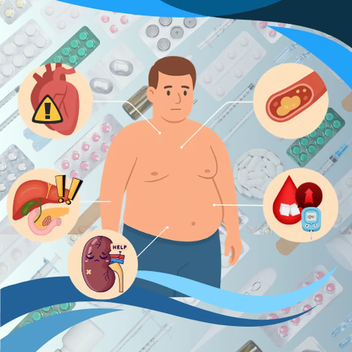 همه چیز در مورد سندرم متابولیک: دروازه ورود به دیابت نوع 2 و بیماریهای قلبی